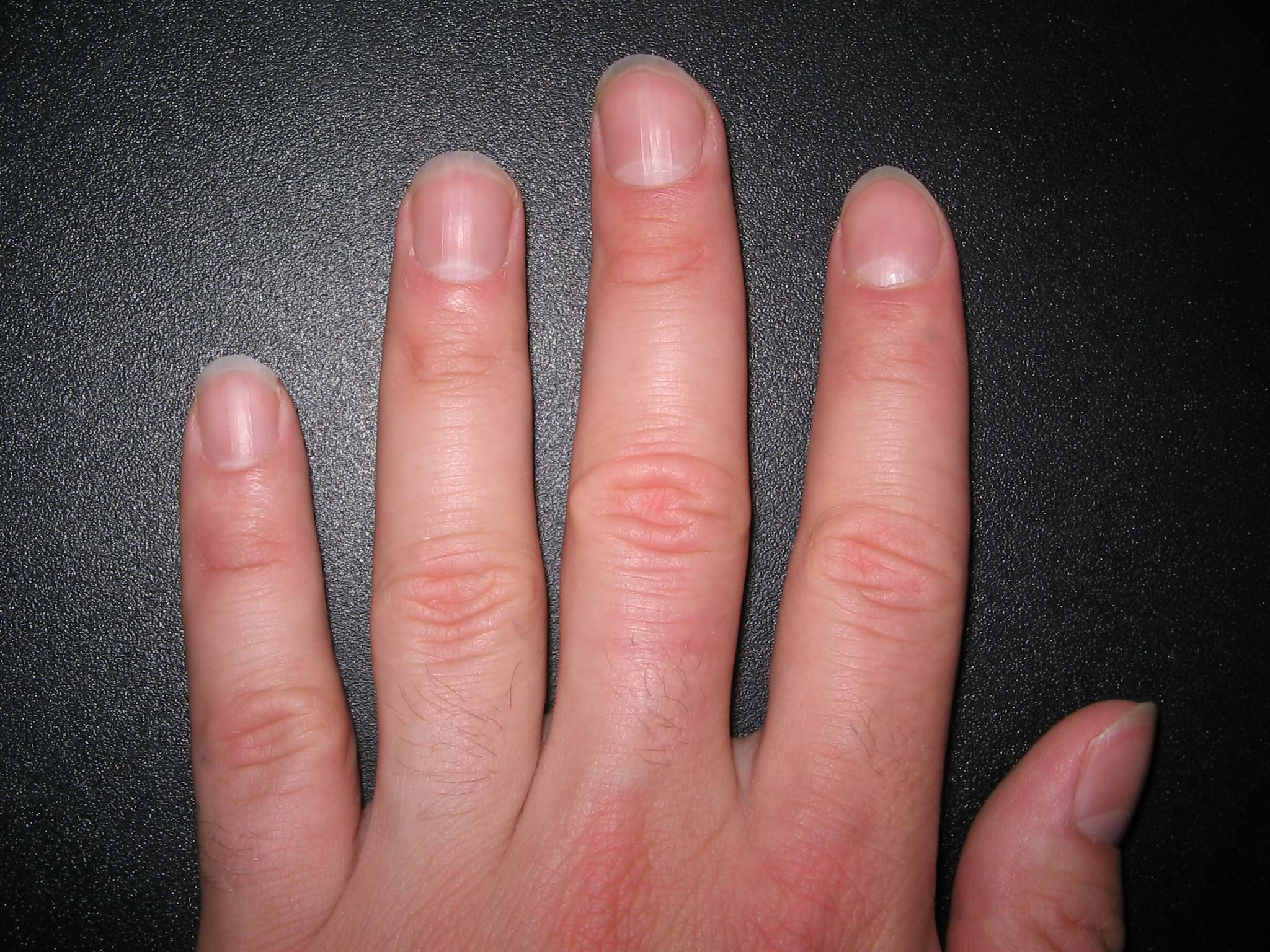 La santé des ongles