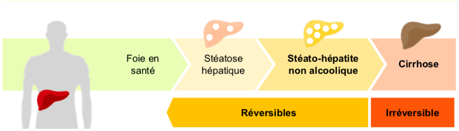 Steatosis