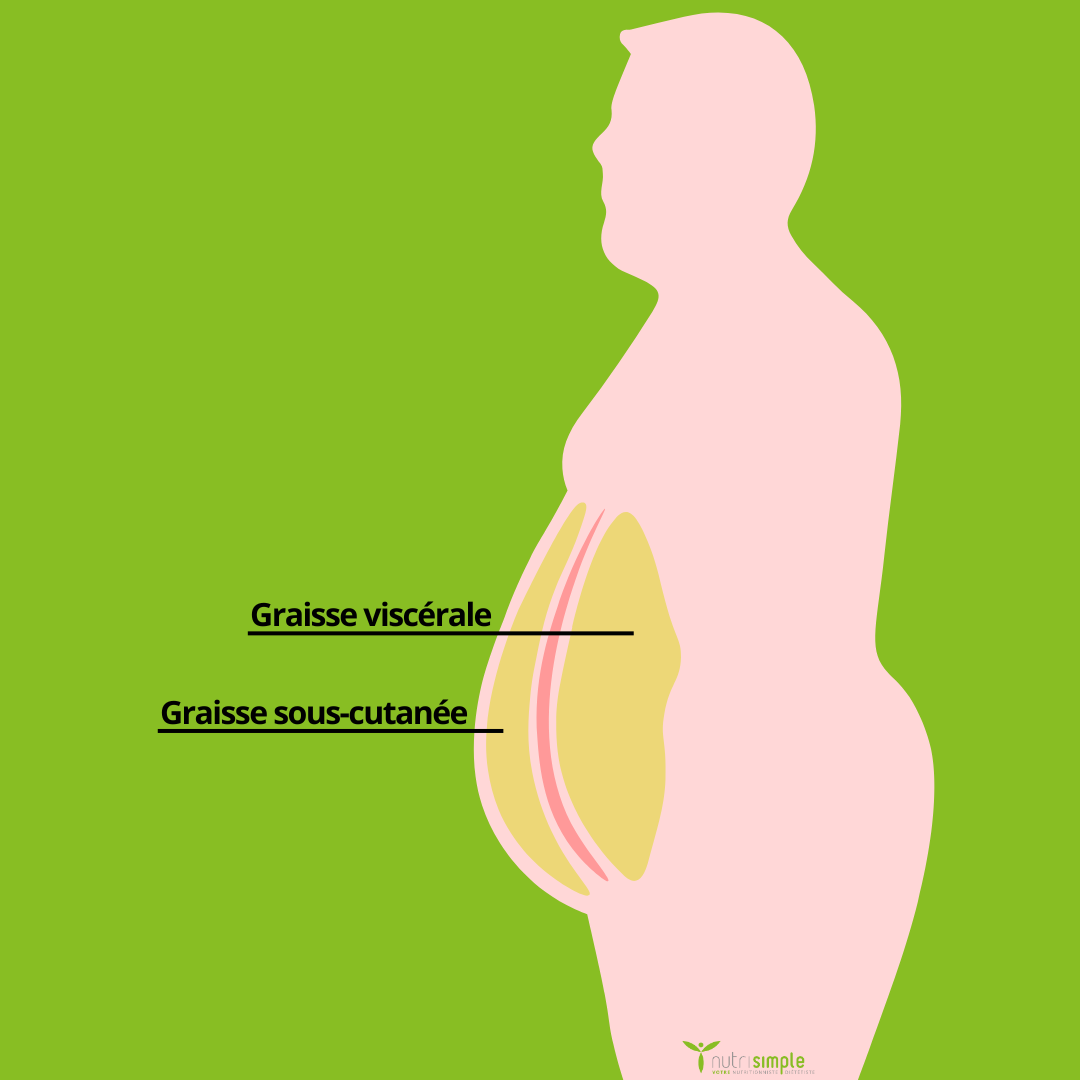 Nouvelle classification de l'obésité : Clinique et Préclinique pour mieux intervenir