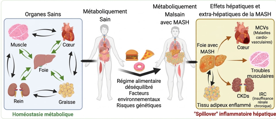 Maladies métaboliques du foie et alimentation | NutriSimple